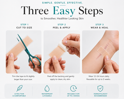 HealTape Pro- For Surgical, Burn & Acne Scars | Women & Men